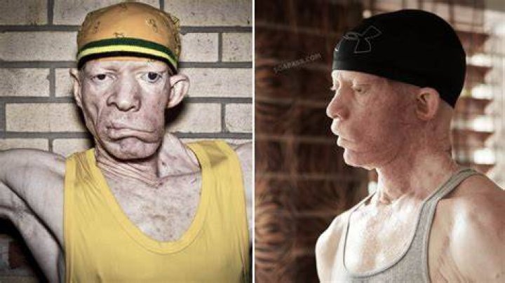Yellowman Face
